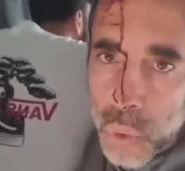 ״מחבלים השתלטו על תא המטוס״: העדות הדרמטית רגע לפני הנחיתה | צפו