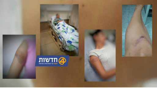 צילום: חדשות 0404 ערבים תקפו יהודים בעכו: שחררו כלב והכו אותם – 3 פונו לביה"ח