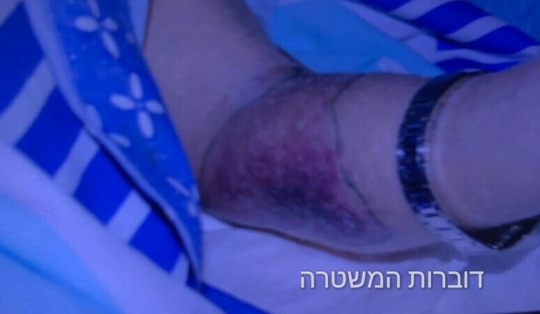 צילום: דוברות המשטרה תושב הדרום הכה קשיש בן 87 שהעיר לו על שעשה צרכיו ליד חלון ביתו