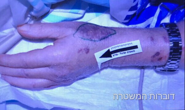 דוברות המשטרה