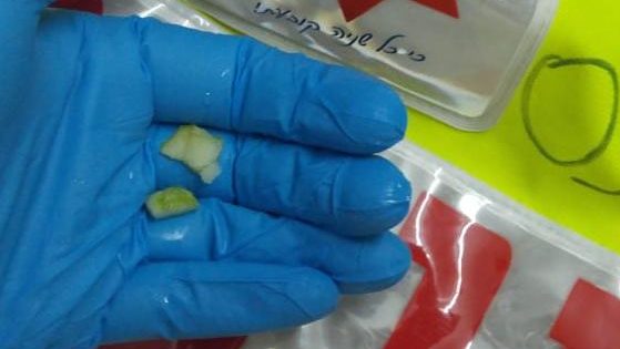 צילום: דוברות ארגון הצלה בזכות כוחות ההצלה, תינוק ניצל לאחר שנחנק מאכילת תפוח בבני ברק