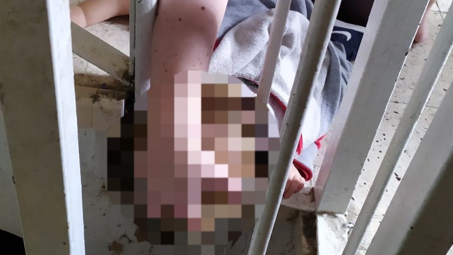 צילום: דוברות כב לוחמי האש חילצו פעוט כבן שנה שראשו נלכד בין סורגים בגן ילדים