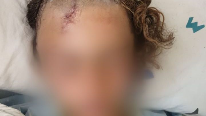 צילום: ארגון חוננו לאחר שפצע באורח קשה נער בן 14: המחבל מהפיגוע בכפר חווארה שוחרר לביתו